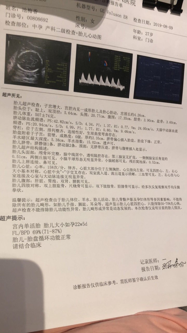 四维彩超报告单