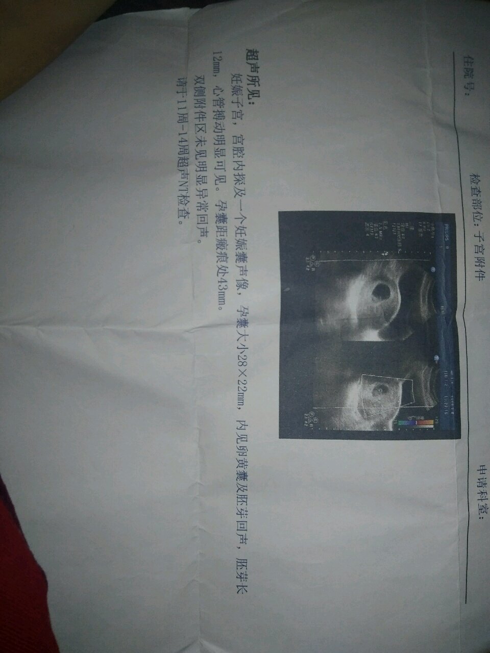 亲看一下男宝还是女宝