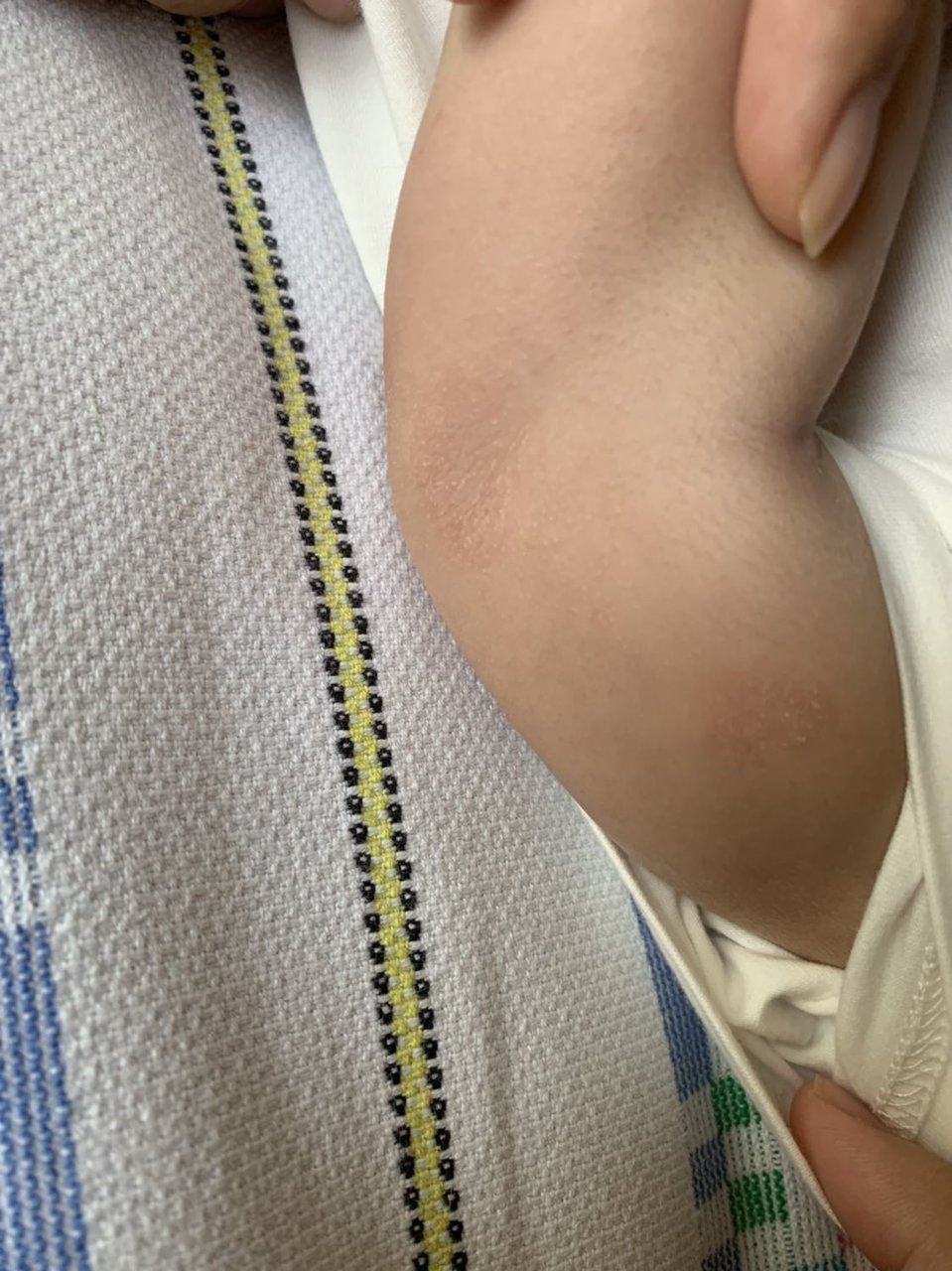 宝宝胳膊上皮肤