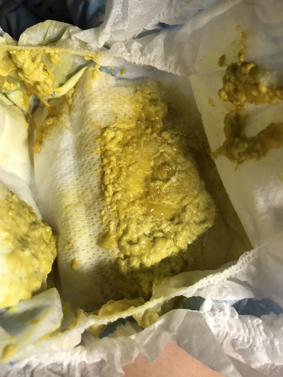 宝宝快七个月，最近总是拉带粘液的大便👀|有图慎入|👀