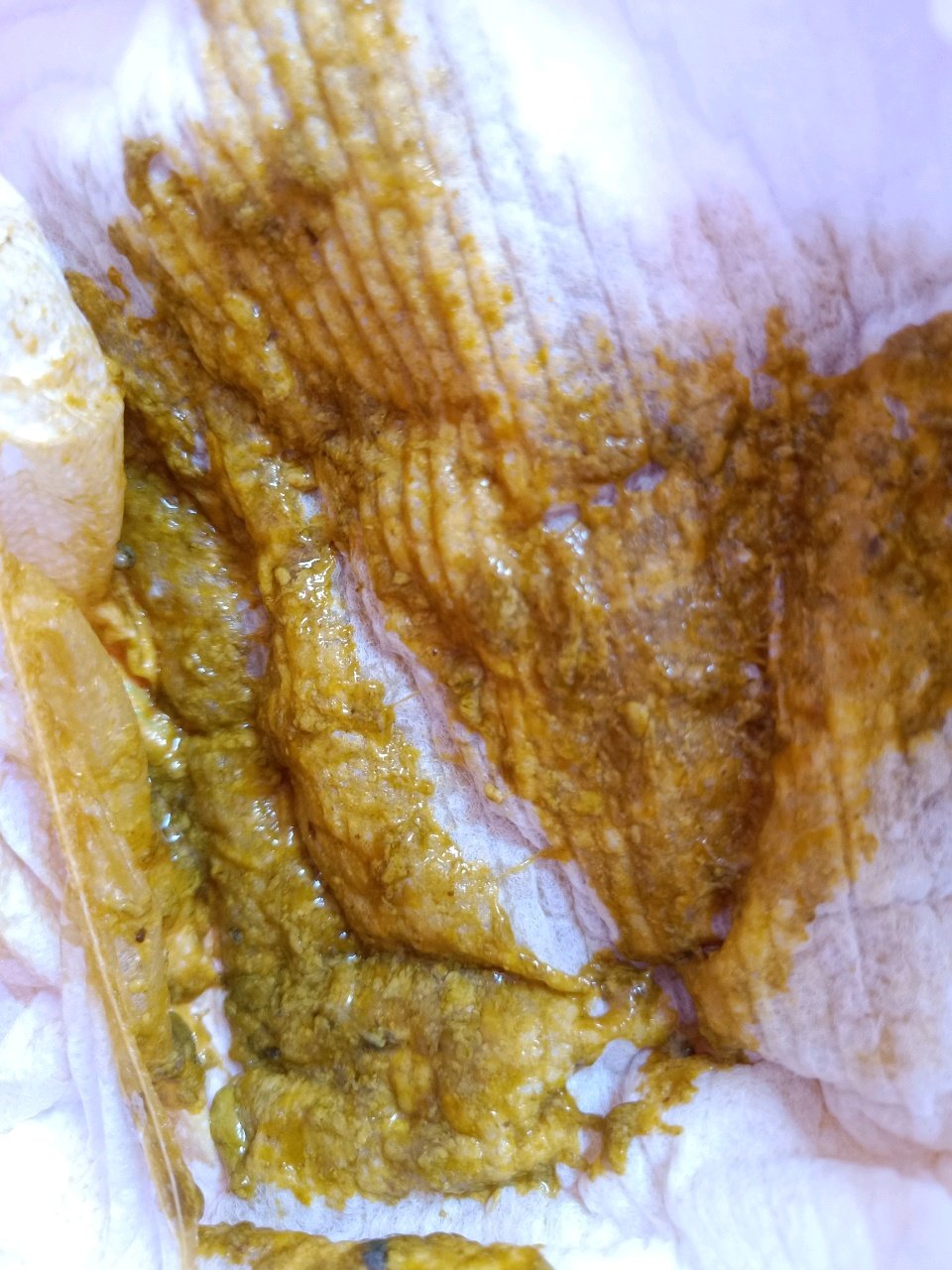 美丽的宝妈们看过来，帮看看这粑粑正常吗