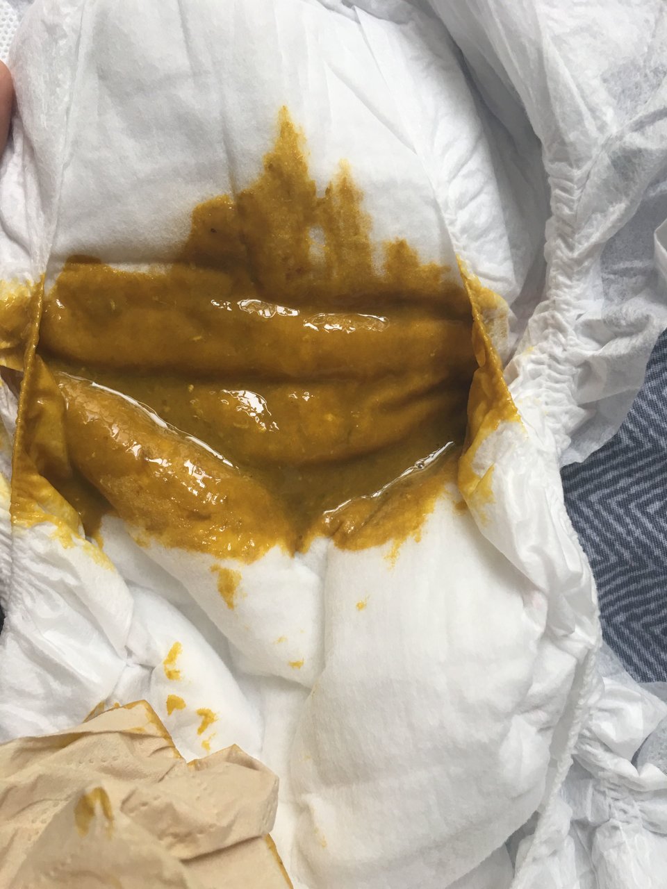 四个月宝宝一天拉三次正常吗？
