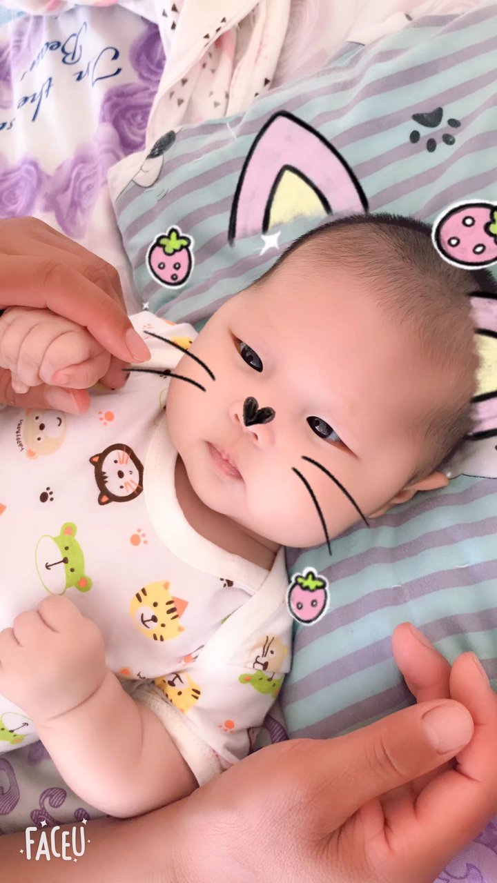 四个半月宝宝  有点对眼  怎么办？？