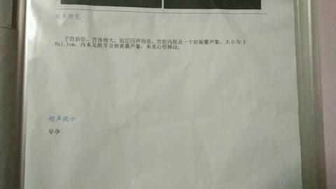 journal_insert_pic_1304732352