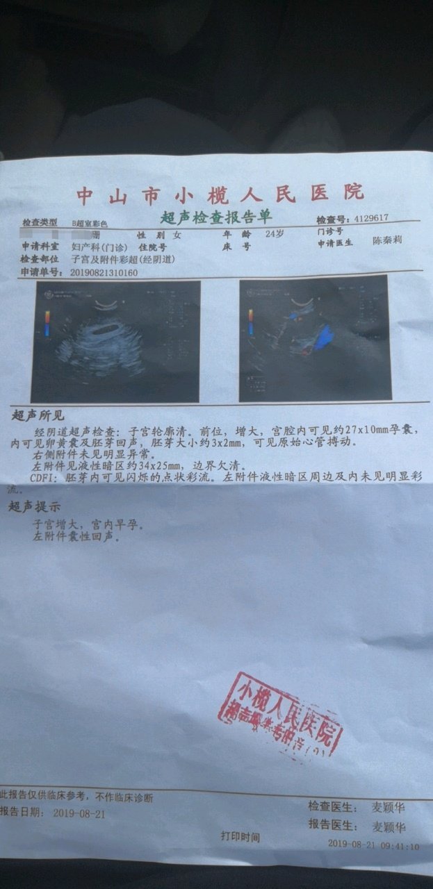 怎么看孕囊位置