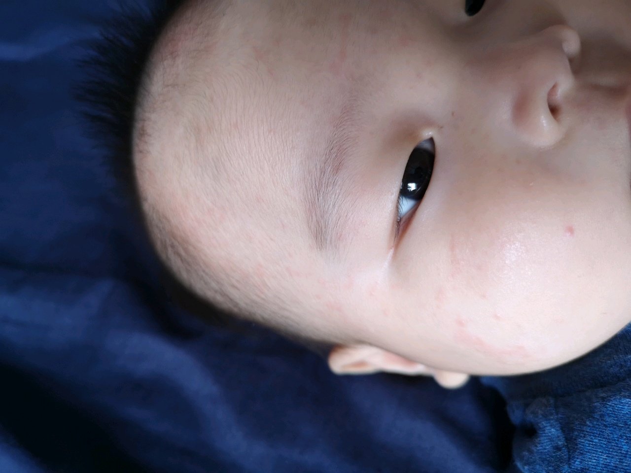 看看是不是幼儿急疹？？？？