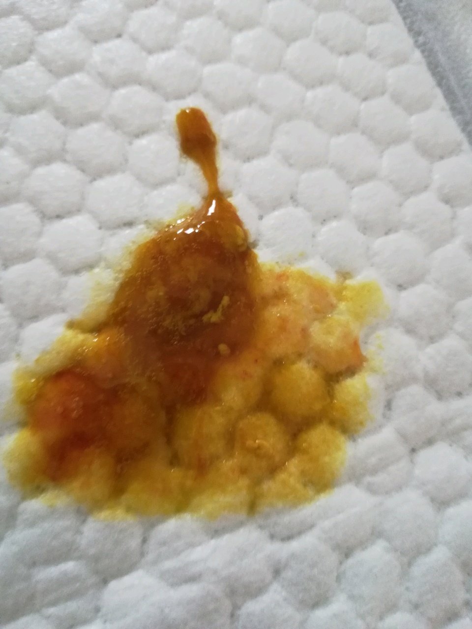 宝宝拉粑粑（有图）