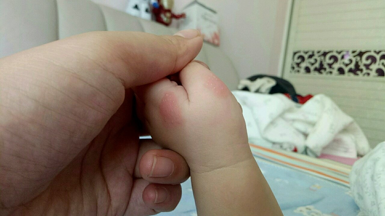 求助宝妈们