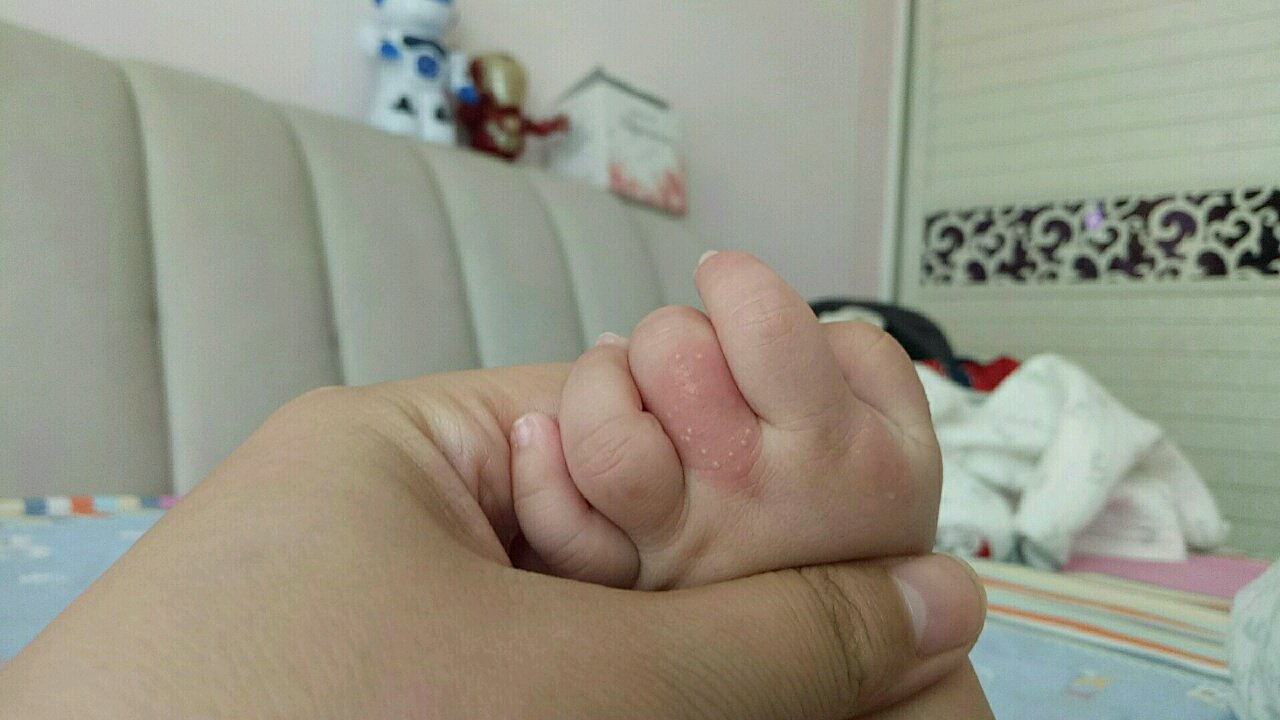 求助宝妈们
