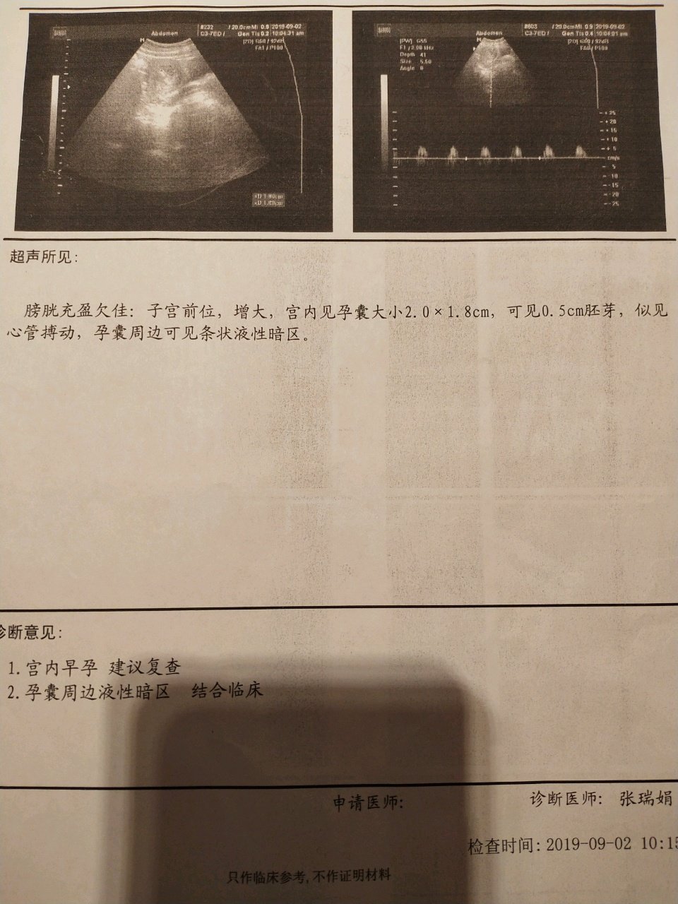 看不懂。