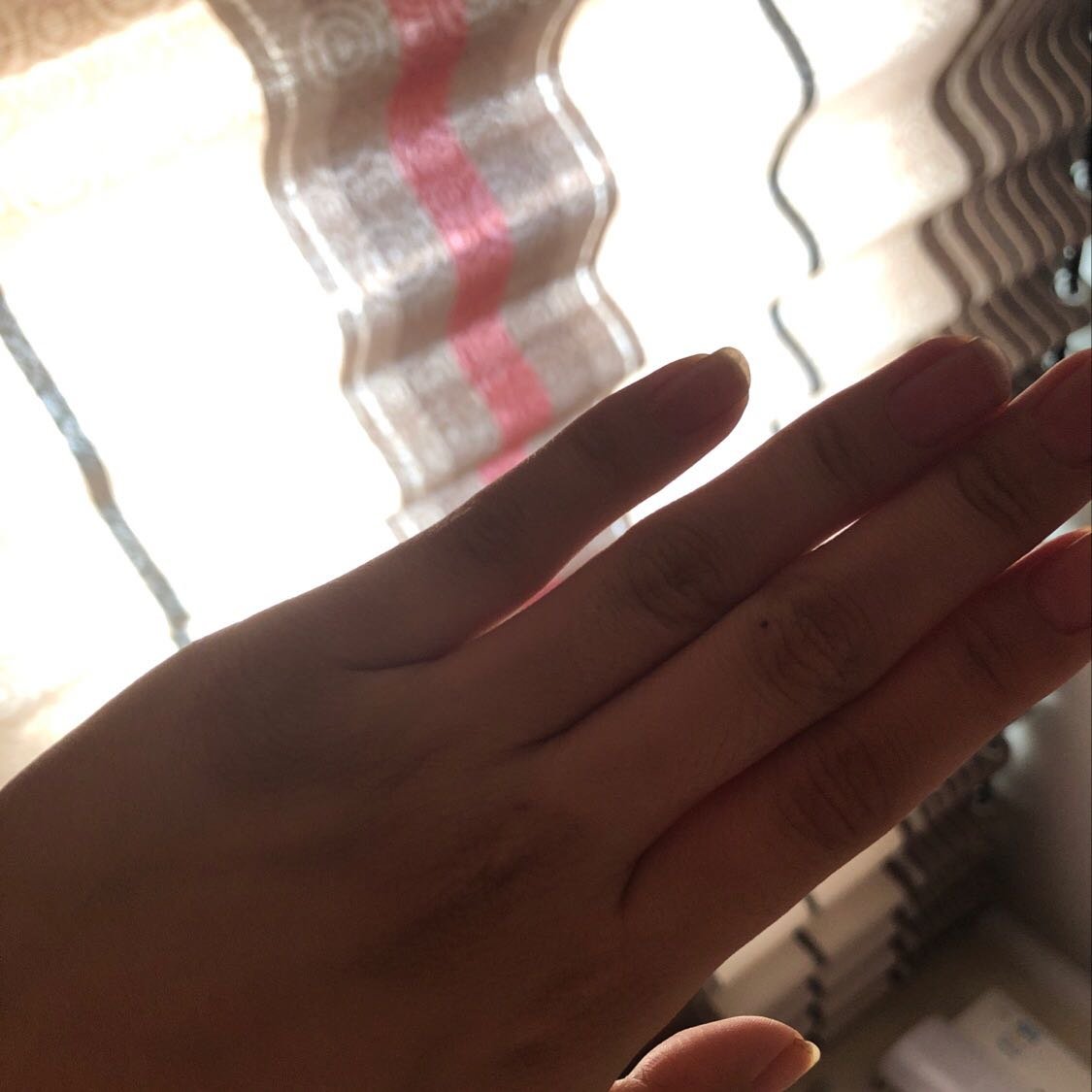 生完宝宝后，手背关节发黑，谁能告诉我为什么？怎么治疗？