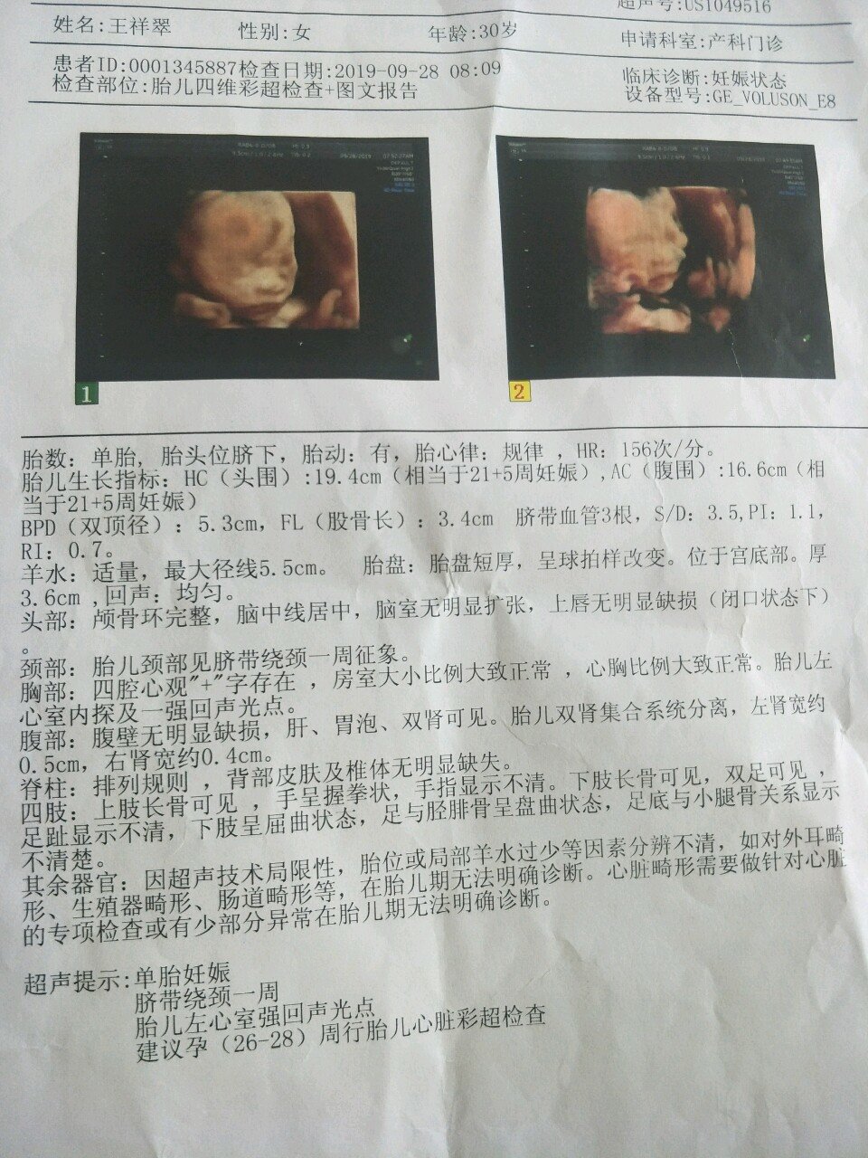 今天做四维宝宝很配合第一个做，一次性就过了