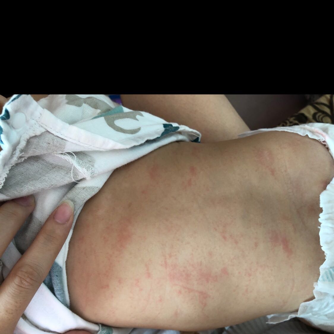 急急急，宝宝突然发高烧，第二天身上有出现了一点一点的红点子！