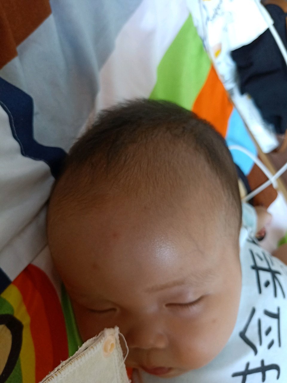 医生说宝宝可能脑积水  大家帮忙看一下像不像