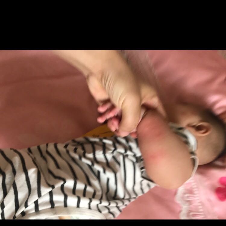 有没有涂蚊子咬有效果的