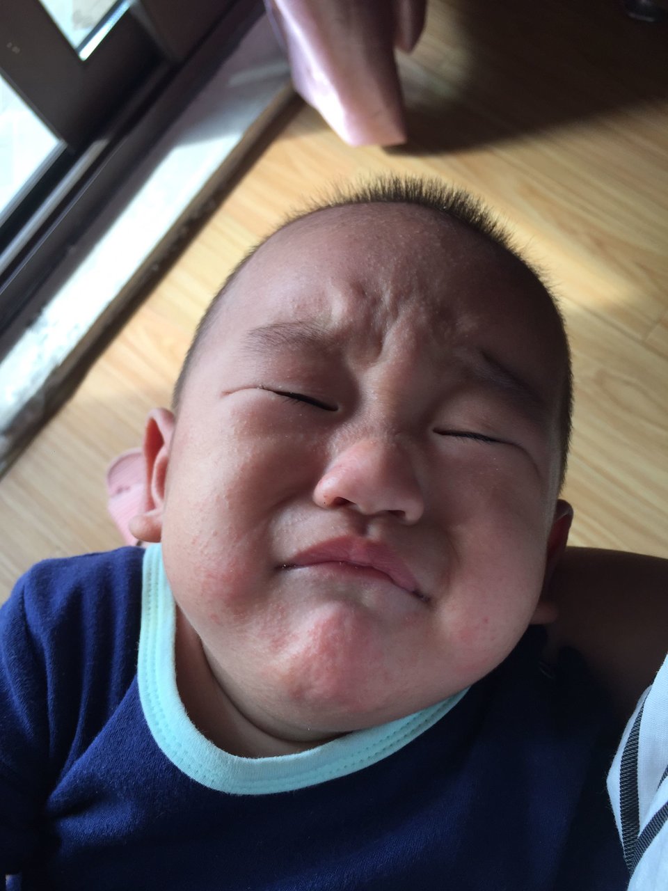 9个月宝宝满脸红点点，有相同的宝宝吗