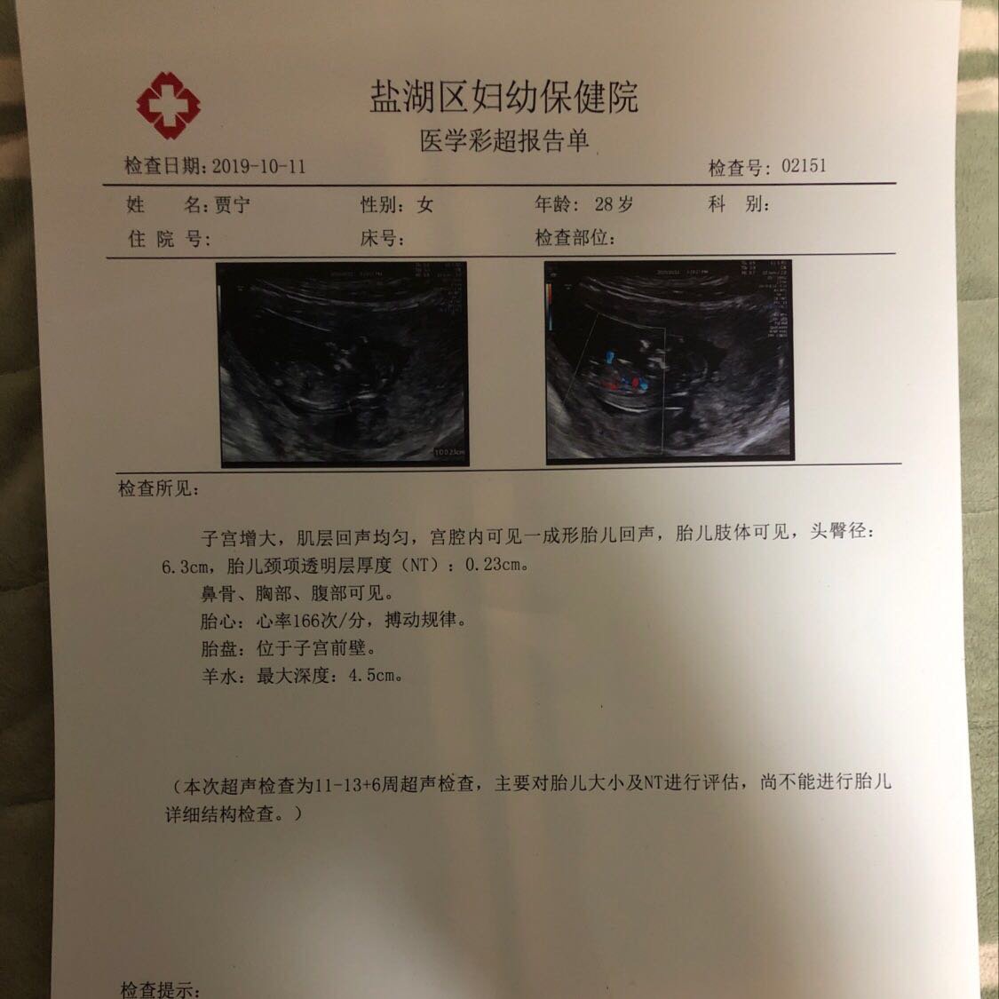 NT顺利通过！
