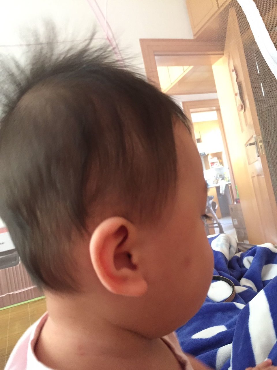 这扁头还有救吗？8个多月了😒