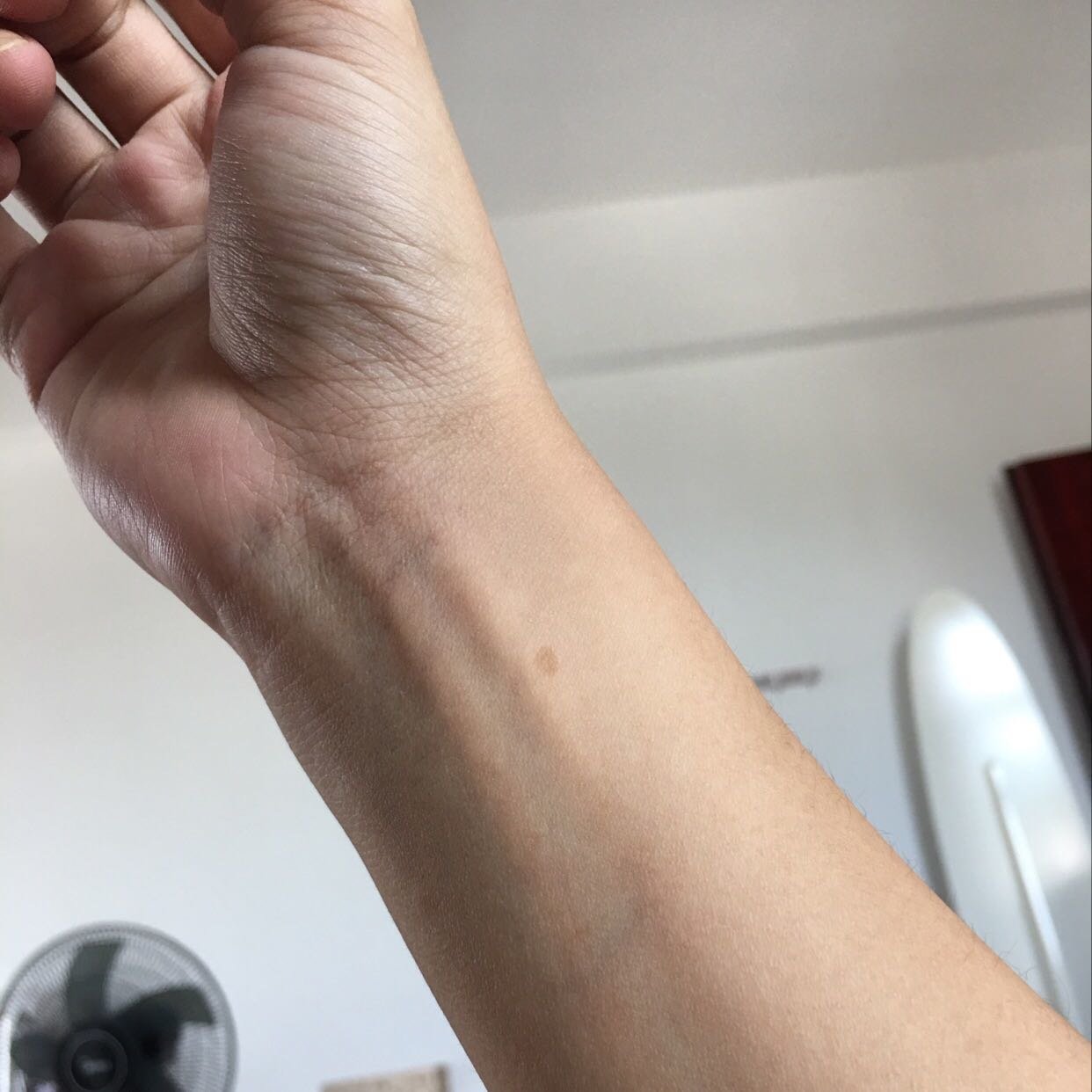 月子里手腕连接大拇指的那根筋痛怎么回事e