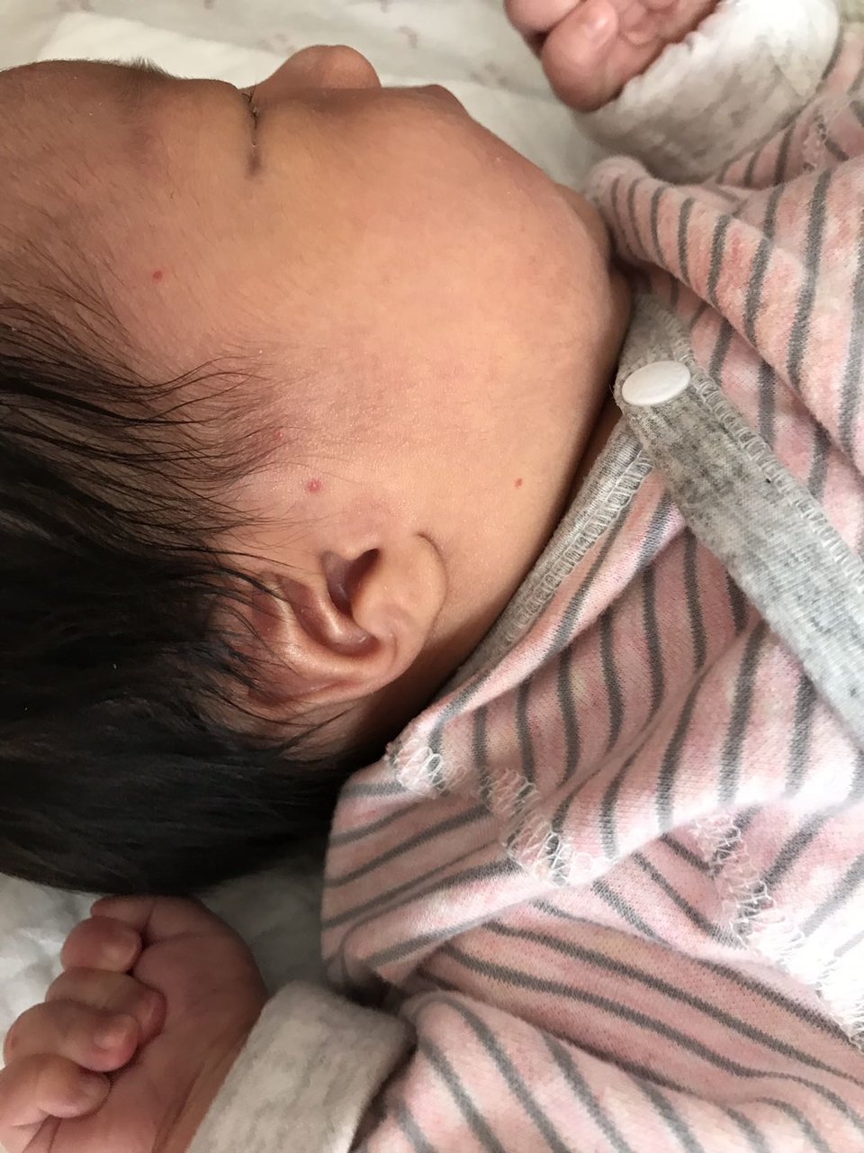 女儿脸上长了几个小红点是啥？