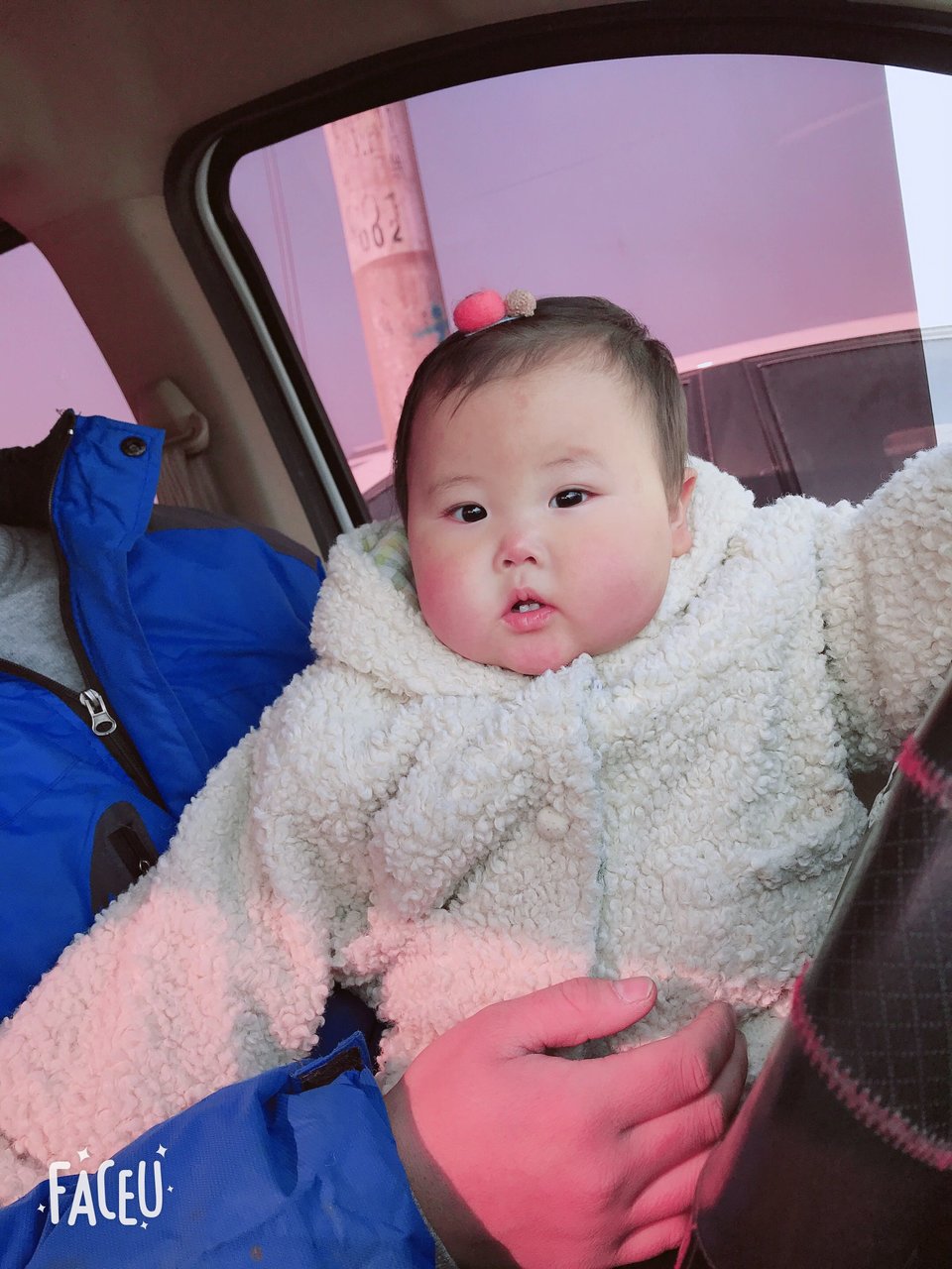 宝宝脸上有鲜红斑痣的宝妈吗！