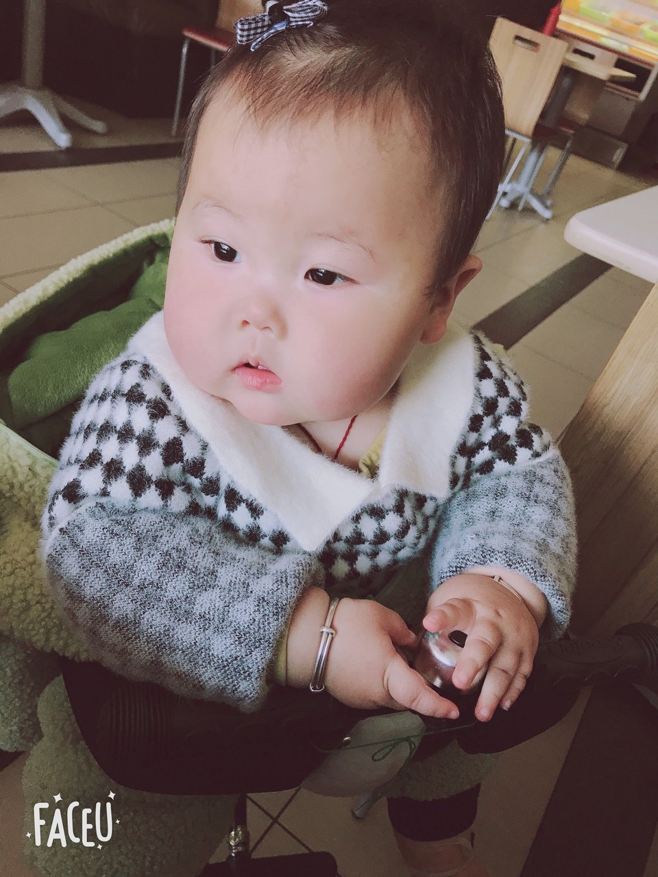 宝宝脸上有鲜红斑痣的宝妈吗！