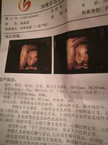 journal_insert_pic_1401091300