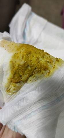 请问宝宝拉这样的臭臭正常吗