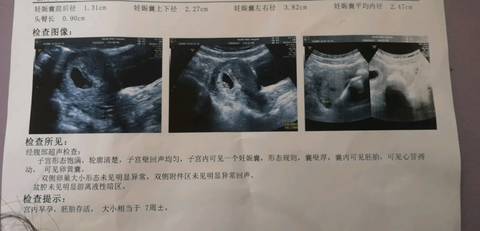 journal_insert_pic_1409765134
