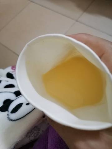 奶水怎么是黄色的呢,宝宝都出生四天了,应该不算是初乳了吧