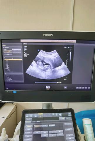 怀孕14周胎儿图片图片