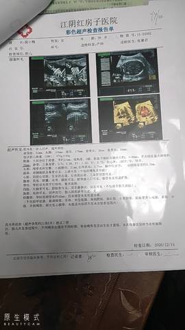 journal_insert_pic_1516830783