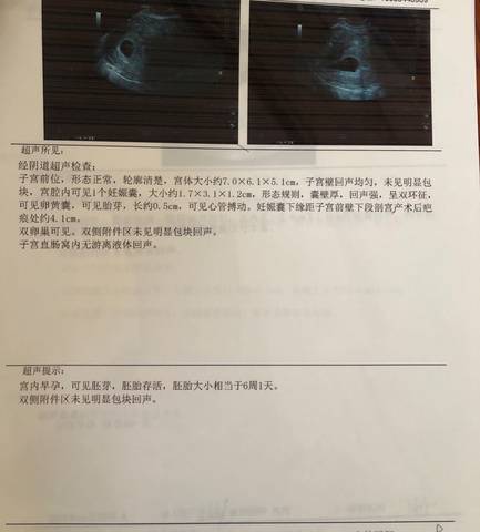journal_insert_pic_1520535426