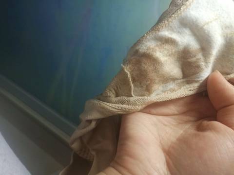 孕早期 有褐色分泌物