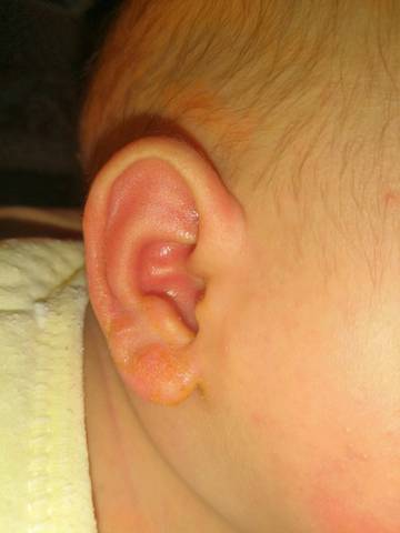 1个月婴儿油耳朵图片图片