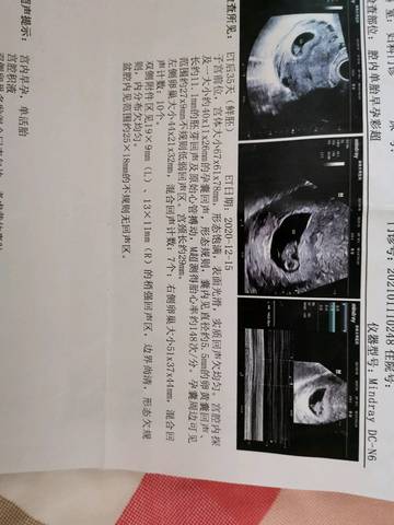 journal_insert_pic_1542457204