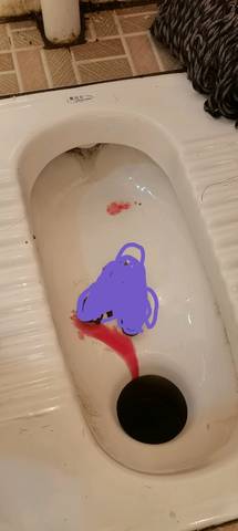厕所血迹图片
