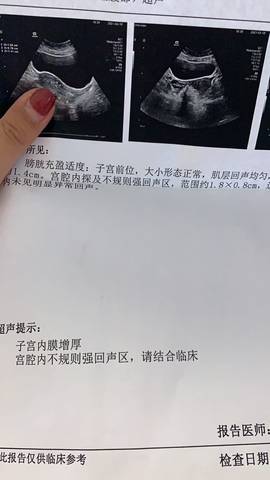 journal_insert_pic_1552961767
