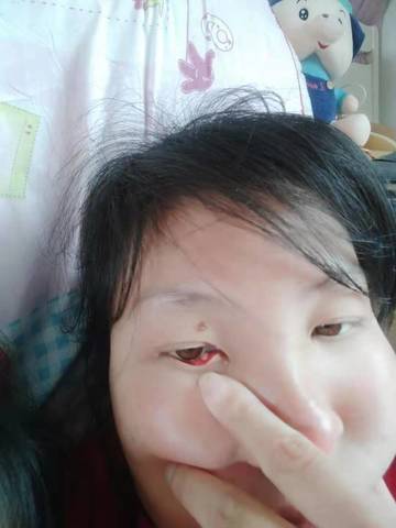 眼睛里面长啥东西