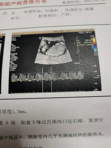 怀孕15周有多大图片图片