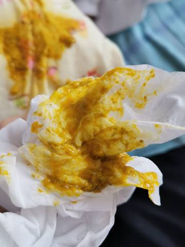 漂亮!一岁宝宝拉稀怎么办"有目共睹"-第2张图片-酷虎博客