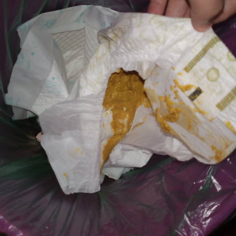 这种粑粑没事吗