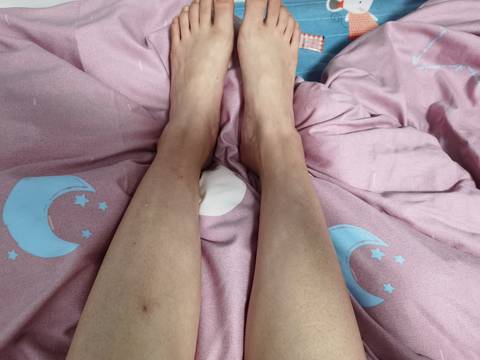 那位小姐姐知道我腿上这是啥啊?