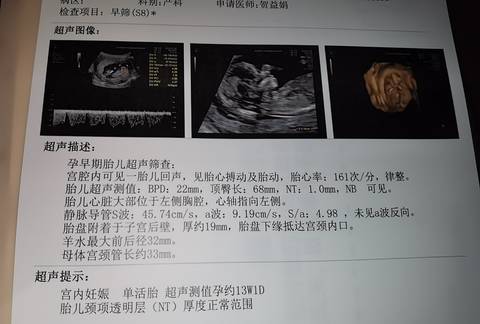 孕8周彩超图片看男女图片