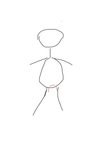 产后第17天了,红色线地方还痛的正常吗?