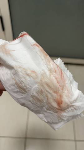 见红是什么样,这属于见红吗