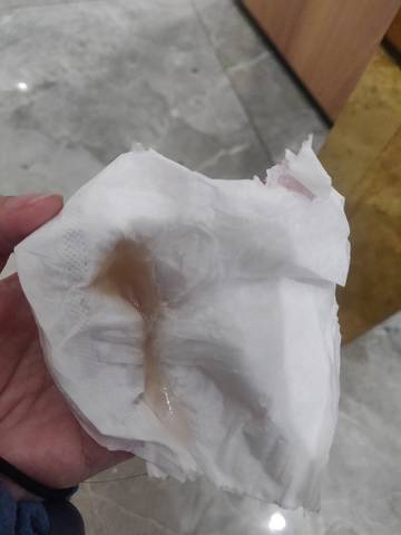 排卵期第二天,白带这样正常吗