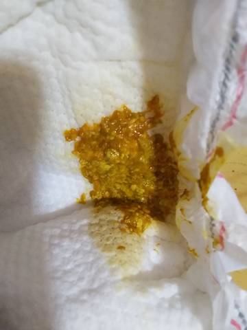 请问宝宝拉这样的粑粑是怎么回事