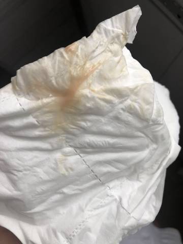 育儿问答 怀孕期 孕16周了,白带有粉色的,请帮忙看下,有图片,请勿喷!