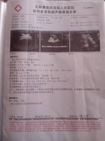 journal_insert_pic_1641753247